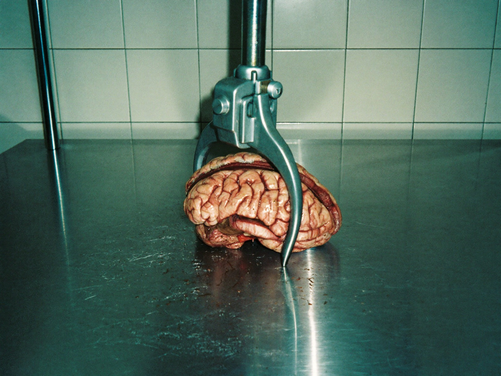 A brain on a steel table slowly compressed in a metal clamp, illustrating chronic cortisol pressure