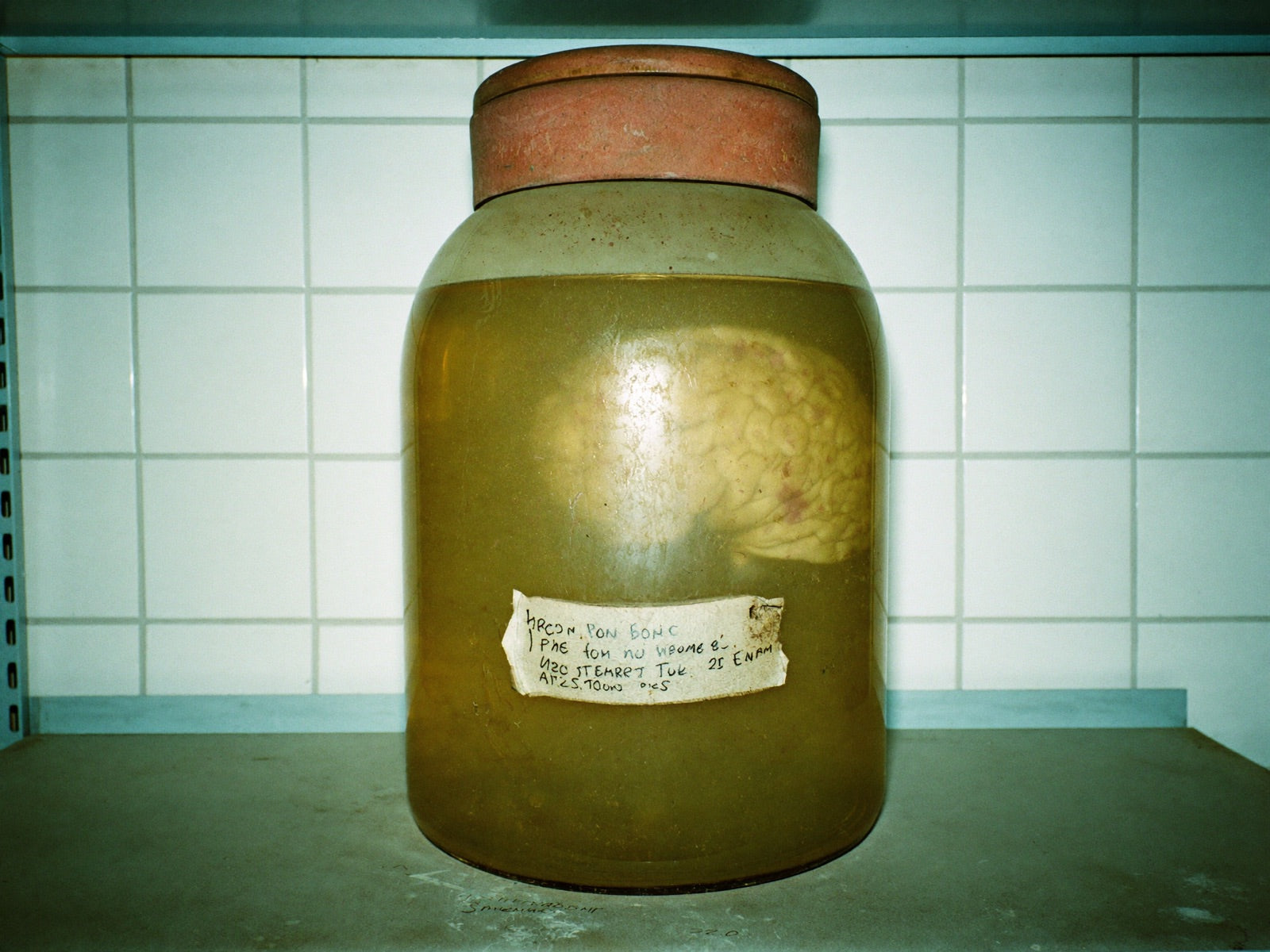 A pale brain preserved in a cloudy specimen jar on an institutional shelf, forgotten